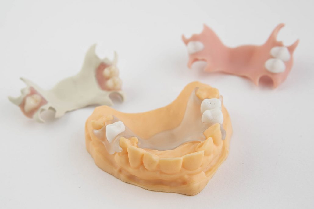 Dental 3D Printing